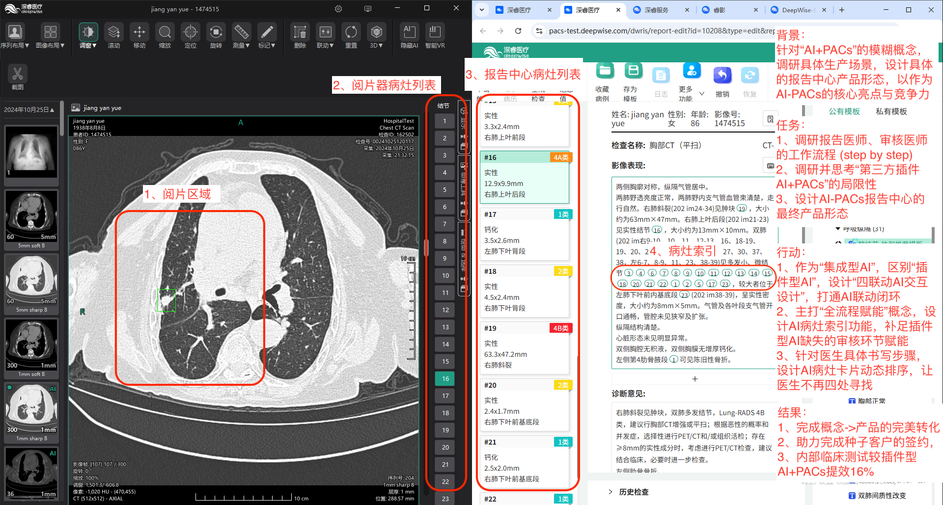 AI-PACs项目介绍